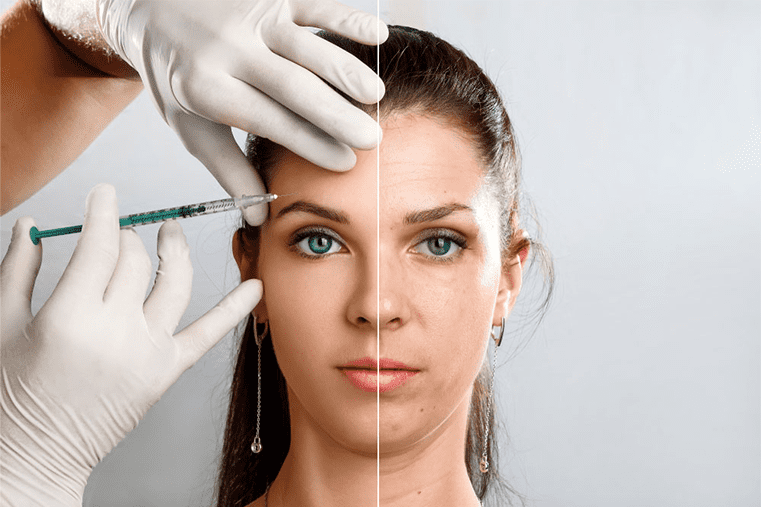 Woman receiving Botox injection in forehead