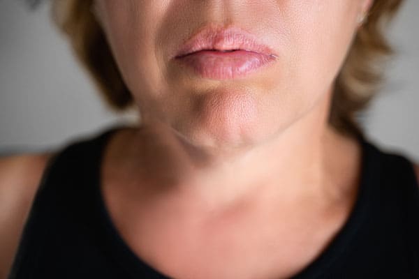 How to get rid of a cleft chin  American Society of Plastic Surgeons