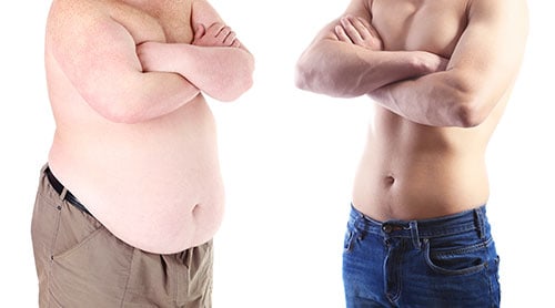 The Abdominal Panniculectomy vs Tummy Tuck in the Extreme Weight Loss  Patient - Explore Plastic Surgery