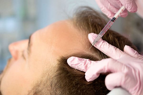 Man receiving Botox injection in scalp