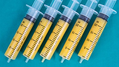 Syringes of fat