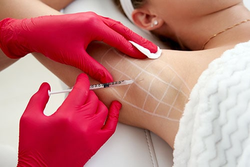 Woman receiving botox for hyperhidrosis