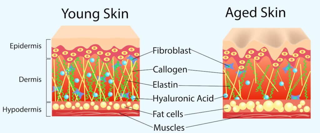 Illustration of young and aged skin components.