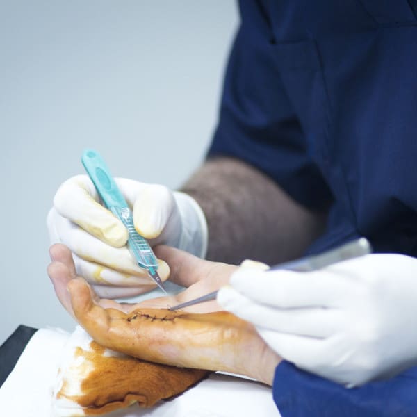 Hand and Wrist Reconstructive Surgery