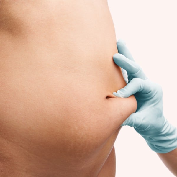 Is liposuction safe?