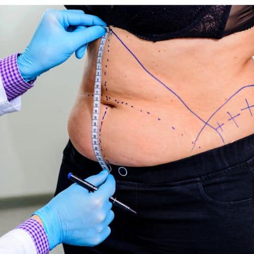 Woman exam for surgery, When is the best time for a mommy makeover